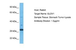 ELOVL1 Rabbit anti-Human, Polyclonal, Novus Biologicals 0.1 mL | Buy Online | Novus Biologicals | Fisher Scientific